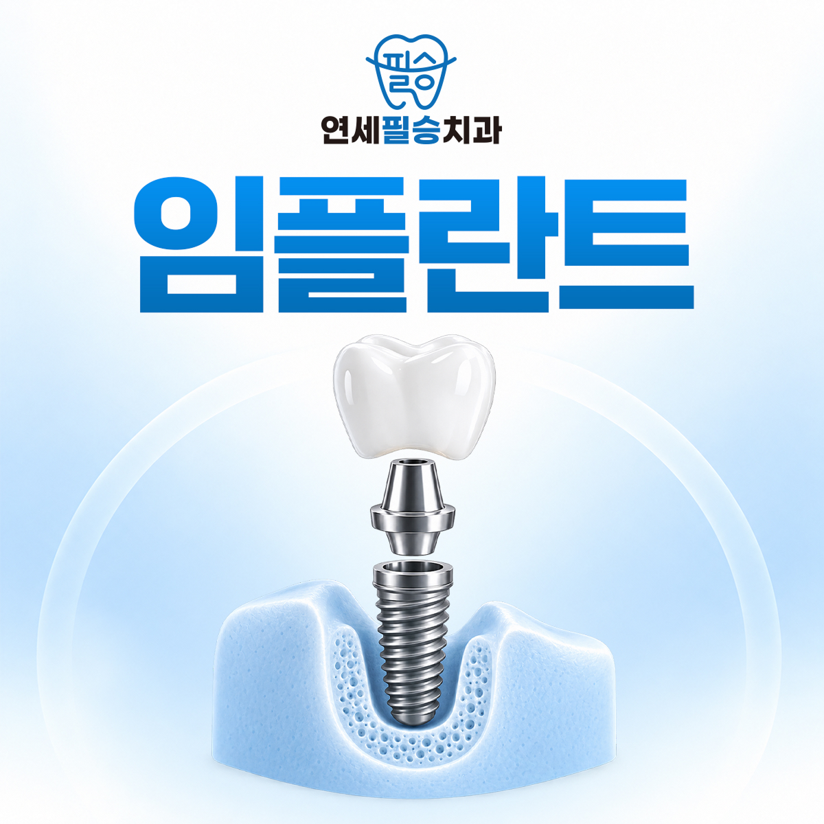 연세필승치과 임플란트